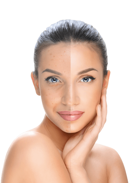 piperina-woman-1-1.png piperina-woman-1-1.png